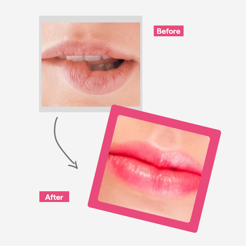 MEDIHEAL Pantenolips Essence Berrypink - 10ml