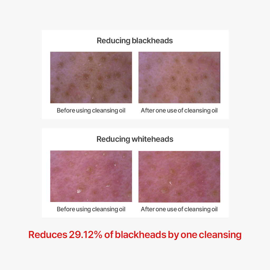 Thank You Farmer Pollufree™ Cleansing Oil - 200ml