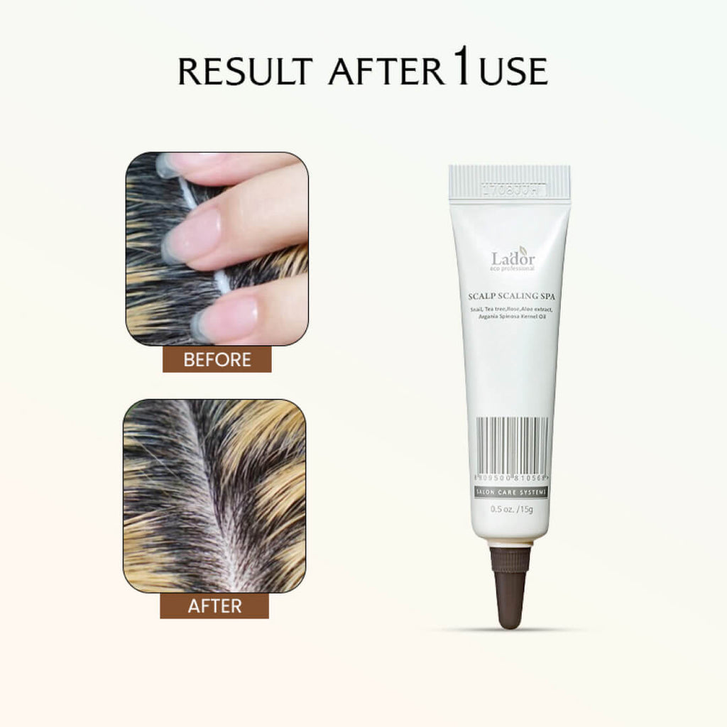 Lador Scalp Scaling Spa - 15gms