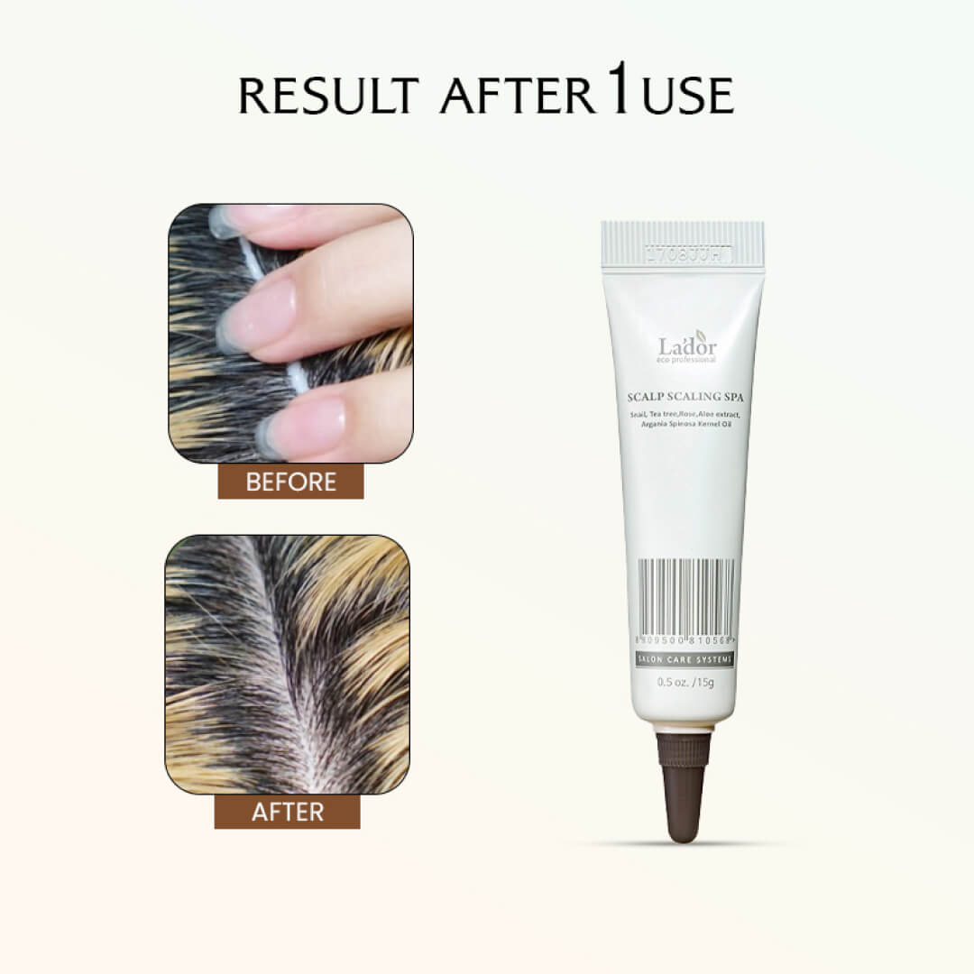Lador Scalp Scaling Spa - 15gms