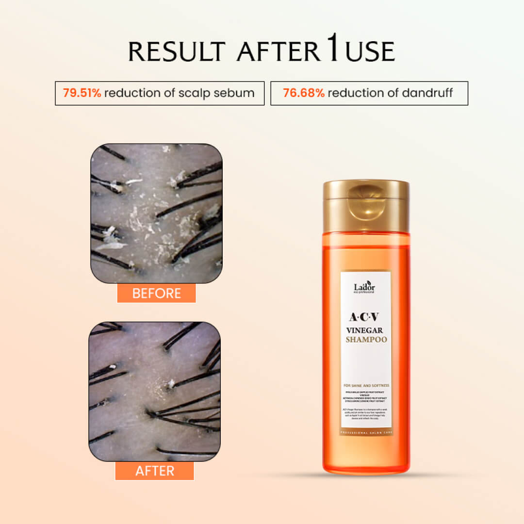 Lador ACV Vinegar Shampoo - 430ml